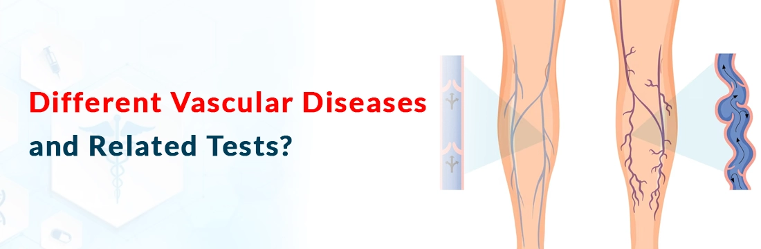  Different Vascular Diseases and Related Tests?